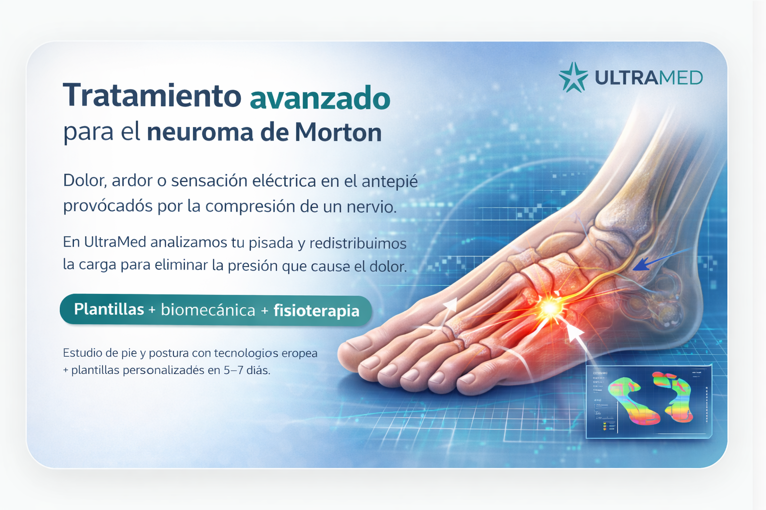 Tratamiento para neuroma de Morton con análisis biomecánico y plantillas ortopédicas personalizadas en UltraMed