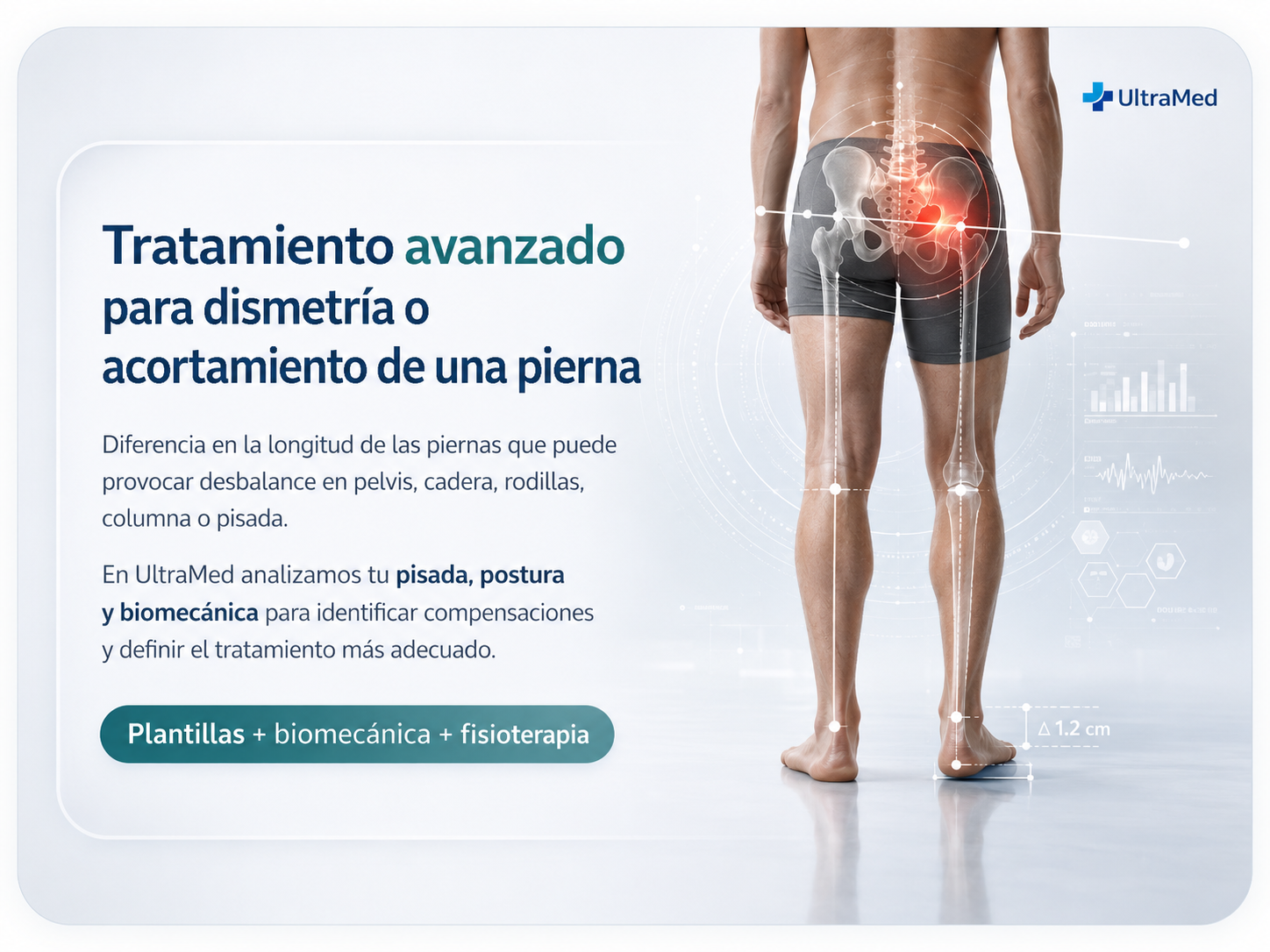 Tratamiento avanzado para dismetría o acortamiento de una pierna con análisis biomecánico UltraMed