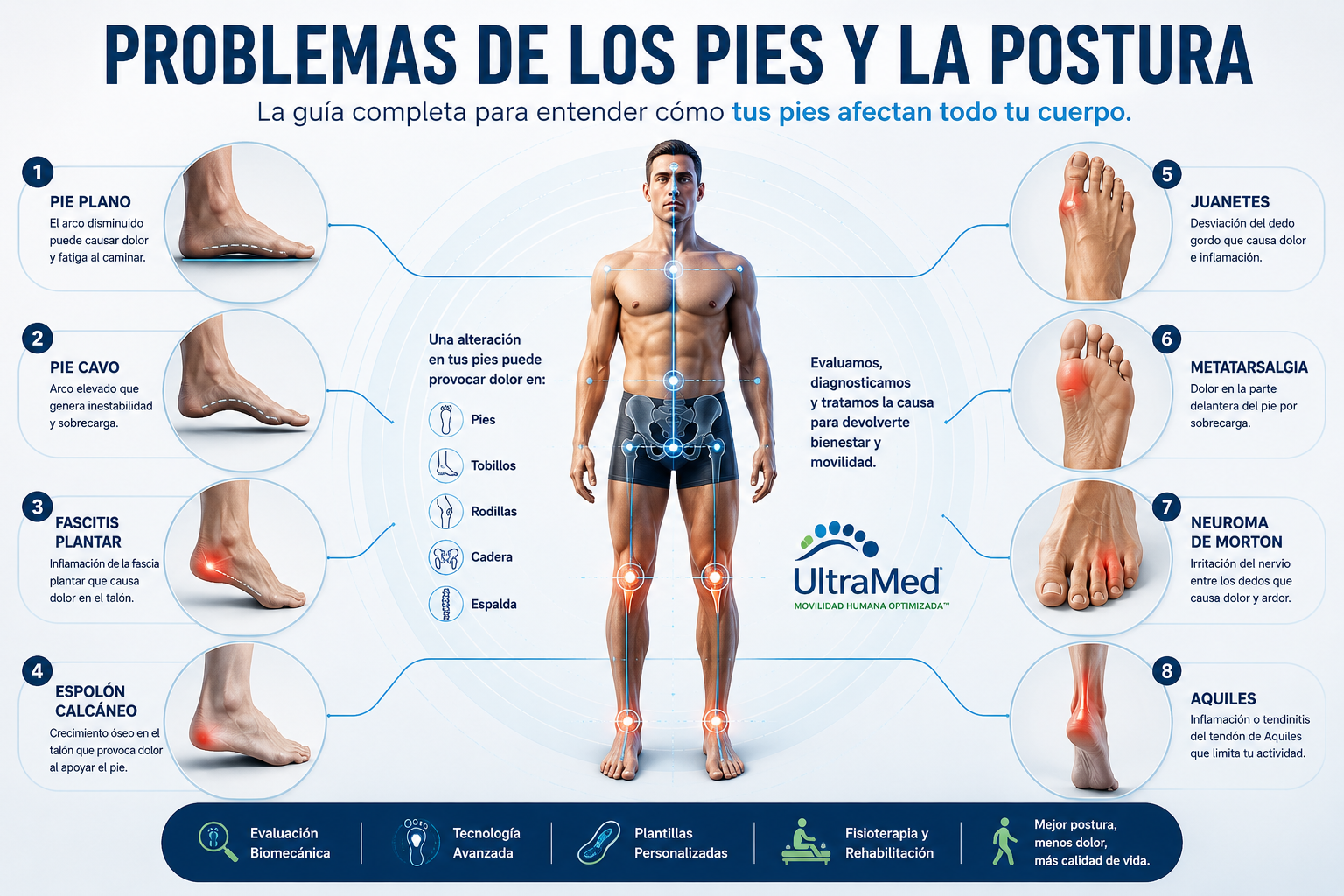 Problemas de los pies y la postura: pie plano, pie cavo, fascitis plantar, espolón calcáneo, juanetes, metatarsalgia, neuroma de Morton y tendón de Aquiles