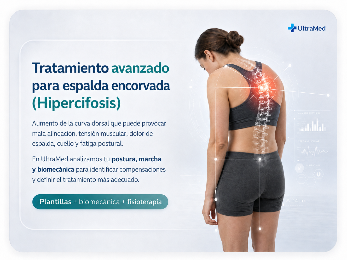 Tratamiento avanzado para espalda encorvada o hipercifosis en UltraMed con análisis de postura, marcha y biomecánica