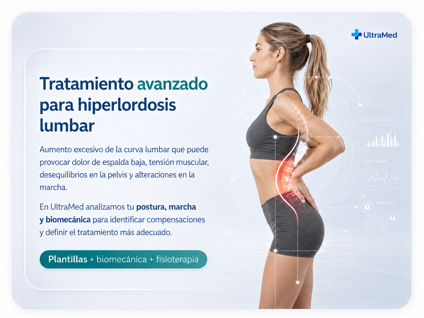 Tratamiento avanzado para hiperlordosis lumbar en UltraMed con análisis de postura, marcha y biomecánica