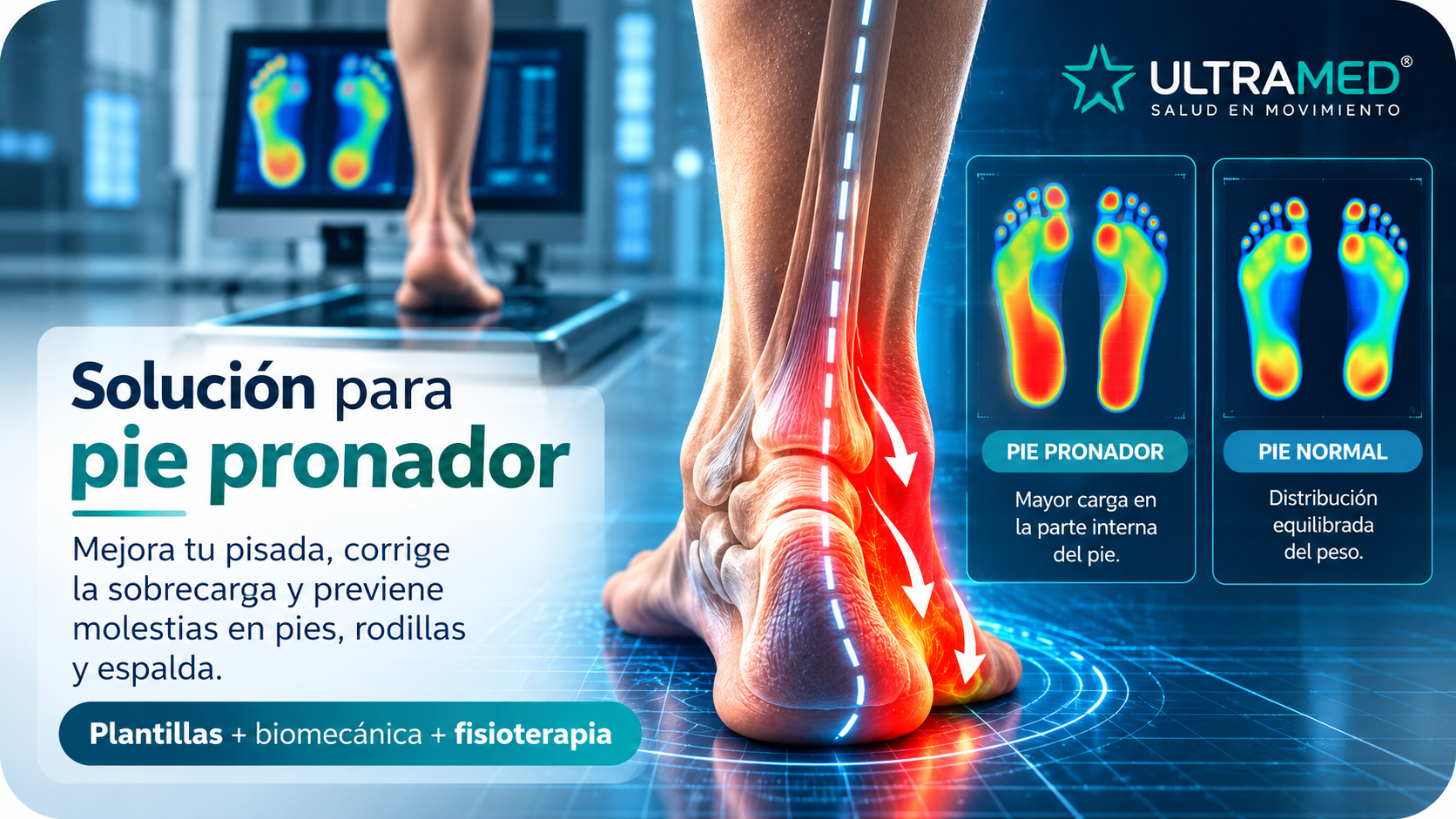 Pie pronador y sobrepronación analizados mediante estudio biomecánico y distribución de presión plantar