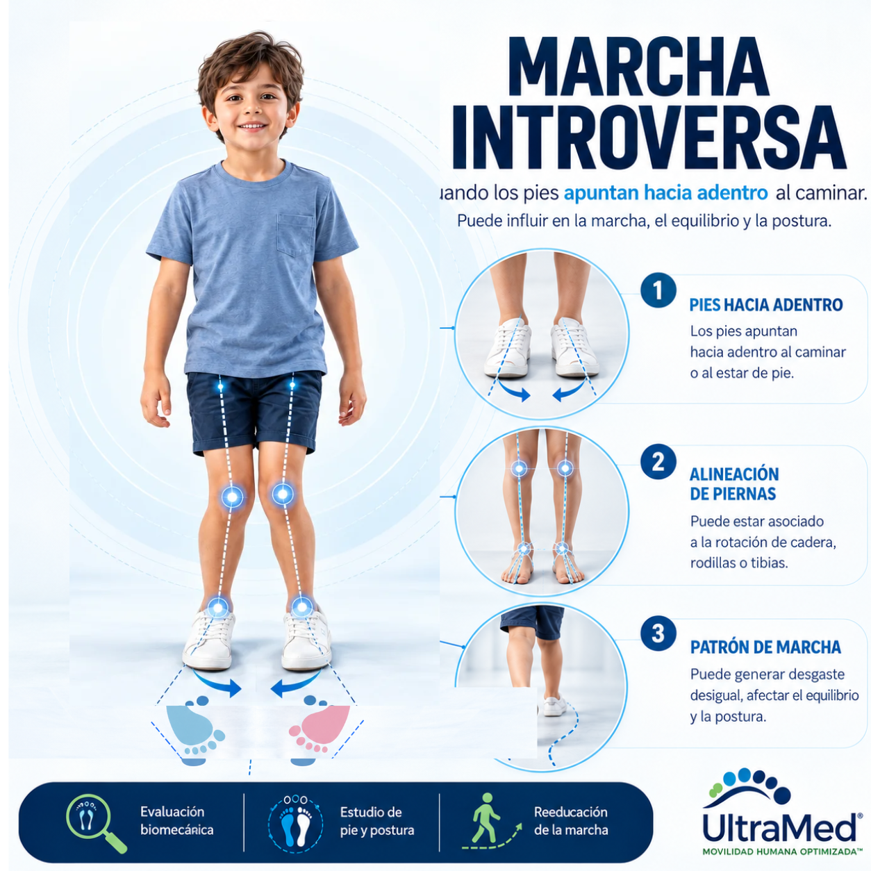 Niño con marcha introversa: ilustración biomecánica de pies orientados hacia adentro y huellas convergentes.